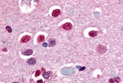 Invitrogen NOR-1 Polyclonal Antibody 25 &mu;g; Unconjugated:Antibodies,