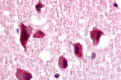 Invitrogen TLX Polyclonal Antibody 25 &mu;g; Unconjugated:Antibodies, Polyclonal