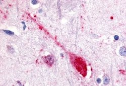 GPR85 Polyclonal Antibody, Invitrogen 25 &mu;g | Buy Online | Thermo Scientific | Fisher Scientific