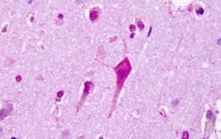 Invitrogen HTR7 Polyclonal Antibody 25 &mu;g; Unconjugated:Antibodies,