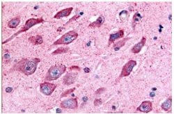 Invitrogen TAOK1 Polyclonal Antibody 25 &mu;g; Unconjugated:Antibodies,