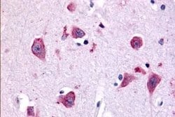 Invitrogen TAOK1 Polyclonal Antibody 25 &mu;g; Unconjugated:Antibodies,