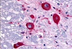 Invitrogen TAOK1 Polyclonal Antibody 25 &mu;g; Unconjugated:Antibodies,