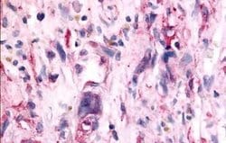 Invitrogen TAOK1 Polyclonal Antibody 25 &mu;g; Unconjugated:Antibodies,