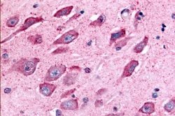 Invitrogen TAOK1 Polyclonal Antibody 25 &mu;g; Unconjugated:Antibodies,