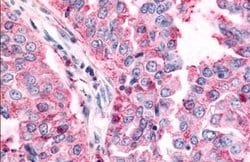 Invitrogen TAOK1 Polyclonal Antibody 25 &mu;g; Unconjugated:Antibodies,