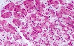 Invitrogen PRKD2 Polyclonal Antibody 25 &mu;g; Unconjugated:Antibodies,