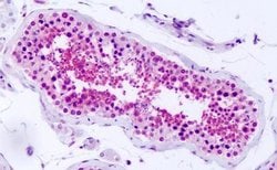 Invitrogen PRKD2 Polyclonal Antibody 25 &mu;g; Unconjugated:Antibodies,