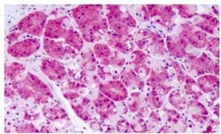 Invitrogen PRKD2 Polyclonal Antibody 25 &mu;g; Unconjugated:Antibodies,