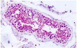 Invitrogen PRKD2 Polyclonal Antibody 25 &mu;g; Unconjugated:Antibodies,