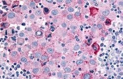 Invitrogen Cdc7 Polyclonal Antibody 25 &mu;g; Unconjugated:Antibodies,