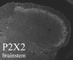 Invitrogen P2X2 Polyclonal Antibody 50 &mu;L; Unconjugated:Antibodies,