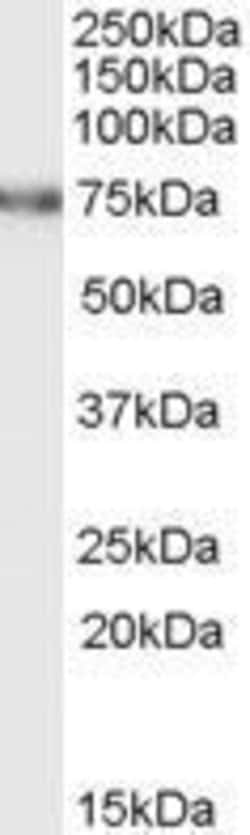 Invitrogen FEM1A Polyclonal Antibody 100 &mu;g; Unconjugated:Antibodies,