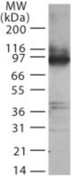 Invitrogen TLR2 Polyclonal Antibody 50 &mu;g | Buy Online | Invitrogen&trade; | Fisher Scientific