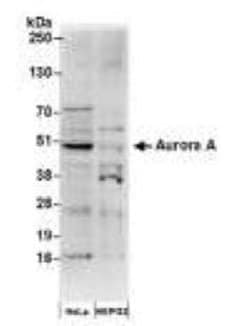 Invitrogen Aurora A Polyclonal Antibody 50 &mu;g; Unconjugated:Antibodies,