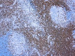 Invitrogen CD3e Polyclonal Antibody 500 &mu;L; Unconjugated:Antibodies,