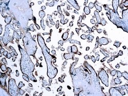 Invitrogen hCG beta Polyclonal Antibody 6 mL; Unconjugated:Antibodies,