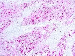 Invitrogen S100 Polyclonal Antibody 6 mL; Unconjugated:Antibodies, Polyclonal