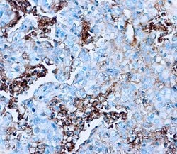 Invitrogen Human Serum Albumin Polyclonal Antibody 1 mL; Unconjugated:Antibodies,