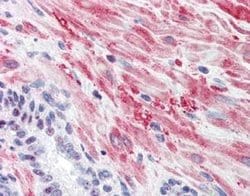 Invitrogen Phospho-GYS1 (Ser640) Polyclonal Antibody 50 &mu;g; Unconjugated:Antibodies,