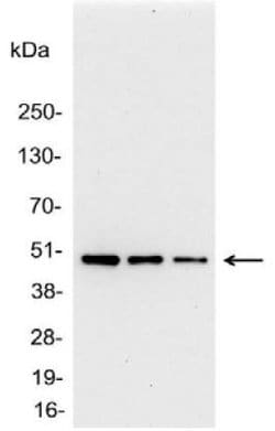 Invitrogen AU1 Tag Polyclonal Antibody 100 &mu;g | Buy Online | Invitrogen&trade; | Fisher Scientific
