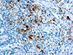 Invitrogen Granzyme B Polyclonal Antibody 500 &mu;L | Buy Online | Invitrogen&trade; | Fisher Scientific