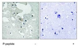 Invitrogen Phospho-BLNK (Tyr84) Polyclonal Antibody 50 &mu;L; Unconjugated:Antibodies,