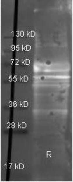 Invitrogen Fibrinogen Polyclonal Antibody 100 &mu;L; Unconjugated:Antibodies,