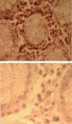 Invitrogen TLR7 Polyclonal Antibody 50 &mu;g | Buy Online | Invitrogen&trade; | Fisher Scientific