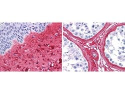 Invitrogen Collagen III Polyclonal Antibody, Biotin 50 &mu;g | Buy Online | Invitrogen&trade; | Fisher Scientific