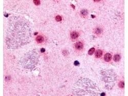 Invitrogen GLI2 Polyclonal Antibody 50 &mu;g; Unconjugated:Antibodies,