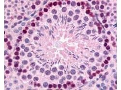 Invitrogen GLI2 Polyclonal Antibody 50 &mu;g; Unconjugated:Antibodies,