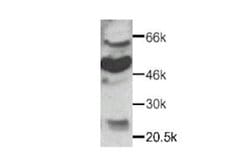 Invitrogen CX3CR1 Polyclonal Antibody 50 &mu;g; Unconjugated:Antibodies,