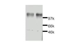 Invitrogen Leptin Receptor Polyclonal Antibody 50 &mu;g; Unconjugated:Antibodies,