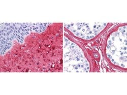 Collagen III Polyclonal Antibody, Invitrogen 100 &mu;g; Unconjugated:Antibodies,