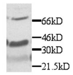 Invitrogen CX3CL1 Polyclonal Antibody 100 &mu;g; Unconjugated:Antibodies,
