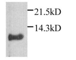 Invitrogen CXCL1 Polyclonal Antibody 50 &mu;g | Buy Online | Invitrogen&trade; | Fisher Scientific