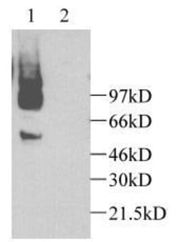 Invitrogen CX3CL1 Polyclonal Antibody 100 &mu;g | Buy Online | Invitrogen&trade; | Fisher Scientific