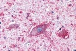 GPCR LS19072 Polyclonal Antibody, Invitrogen 25 &mu;g | Buy Online | Thermo Scientific | Fisher Scientific