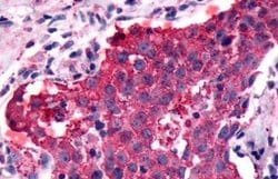 GPCR LS19072 Polyclonal Antibody, Invitrogen 25 &mu;g | Buy Online | Thermo Scientific | Fisher Scientific