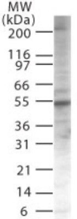 Invitrogen PIASy Polyclonal Antibody 100 &mu;g | Buy Online | Invitrogen&trade; | Fisher Scientific