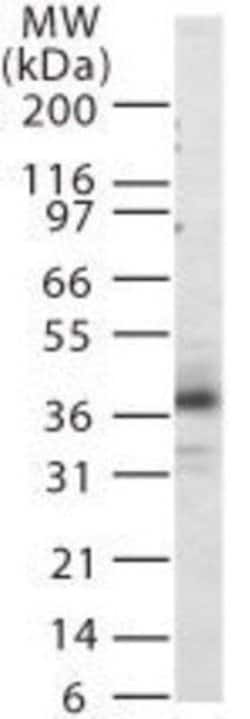 Invitrogen CXCR1 Polyclonal Antibody 100 &mu;g; Unconjugated:Antibodies,