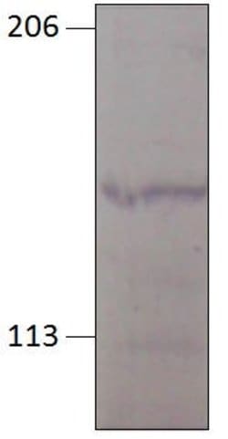 Invitrogen PGCD Polyclonal Antibody 50 &mu;g; Unconjugated:Anticuerpos