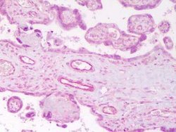 Invitrogen Angiopoietin 2 Polyclonal Antibody 100 &mu;L; Unconjugated:Antibodies,