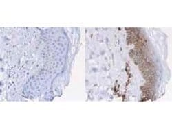 beta-2 Microglobulin Polyclonal Antibody, HRP:Antibodies, Polyclonal
