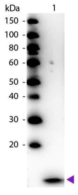 beta-2 Microglobulin Polyclonal Antibody, HRP:Antibodies, Polyclonal