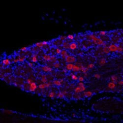 Invitrogen TRPV1 Polyclonal Antibody 50 &mu;L; Unconjugated:Antibodies,