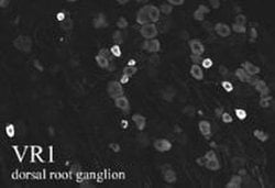 Invitrogen TRPV1 Polyclonal Antibody 50 &mu;L; Unconjugated:Antibodies,