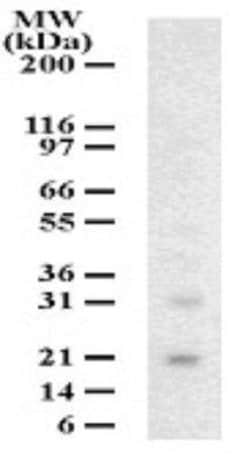Invitrogen DUT Polyclonal Antibody 100 &mu;g | Buy Online | Invitrogen&trade; | Fisher Scientific