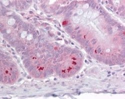 Invitrogen SETD7 Polyclonal Antibody 200 &mu;L; Unconjugated:Antibodies,
